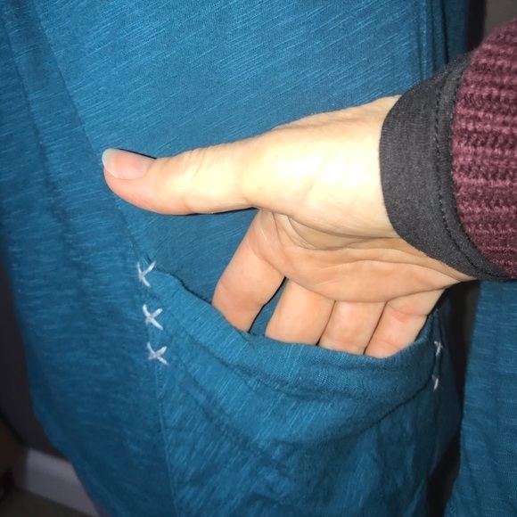 Anthropologie Little Yellow Button Teal High/Low Top – Size XS - Picture 3 of 6